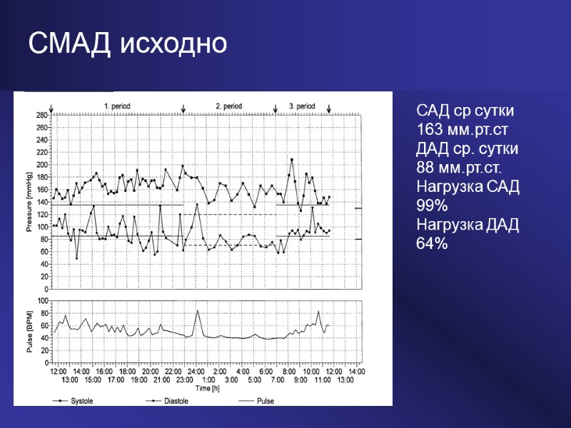 СМАД исходно САД ср сутки 163 мм.рт.ст ДАД ср. сутки 88 мм.рт.ст. Нагрузка САД